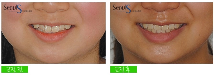 ex_orth_parkyekyoung (1)