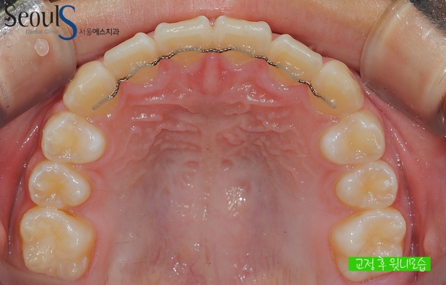 ex_orth_parkyekyoung (10)