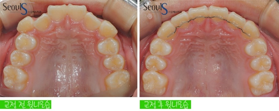 ex_orth_parkyekyoung (11)