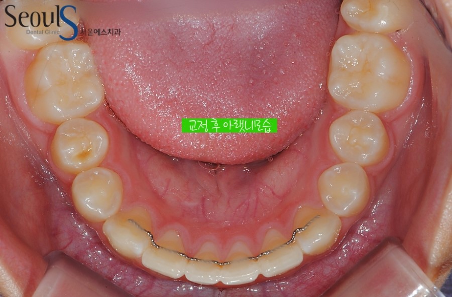 ex_orth_parkyekyoung (12)
