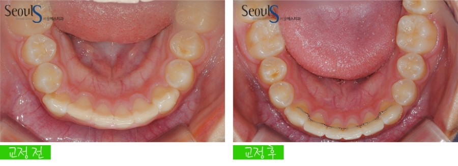 ex_orth_parkyekyoung (13)