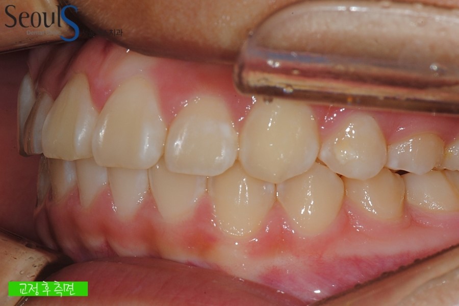 ex_orth_parkyekyoung (14)