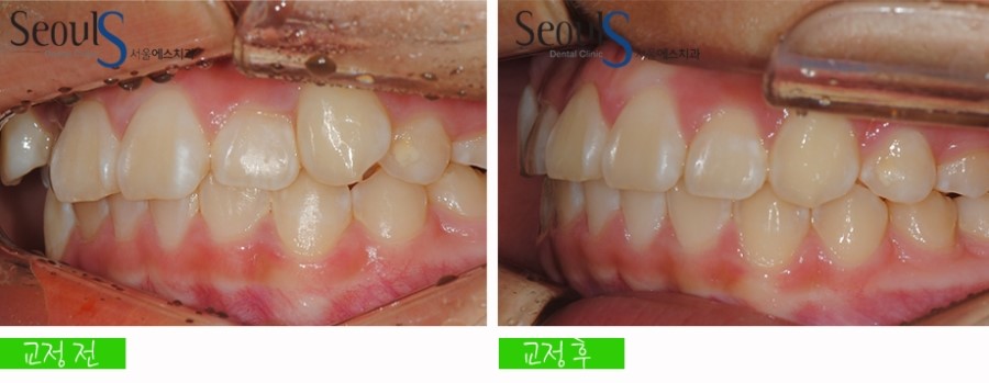 ex_orth_parkyekyoung (15)