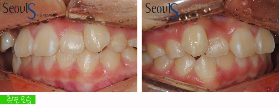 ex_orth_parkyekyoung (3)