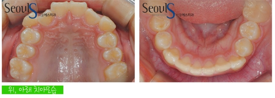 ex_orth_parkyekyoung (4)