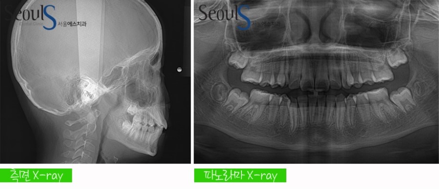 ex_orth_parkyekyoung (5)