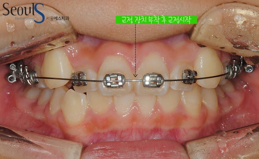 ex_orth_parkyekyoung (6)