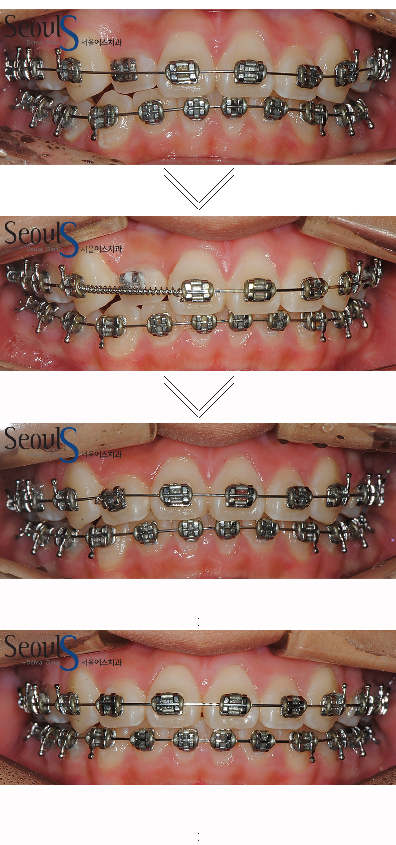 ex_orth_parkyekyoung (7)