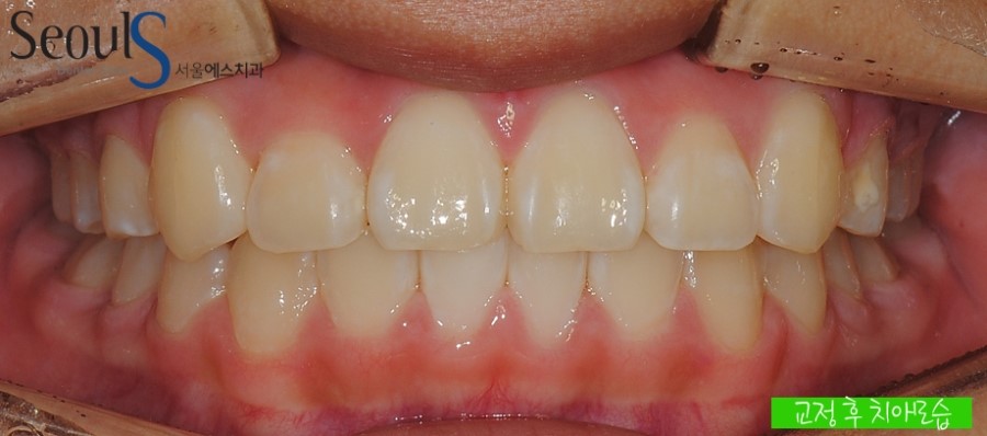 ex_orth_parkyekyoung (8)