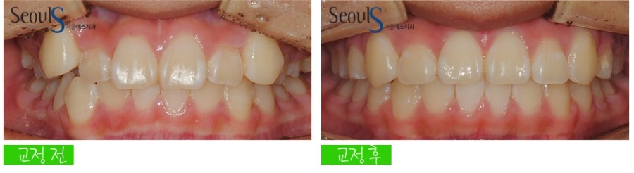 ex_orth_parkyekyoung (9)