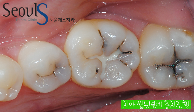 chungchi_03