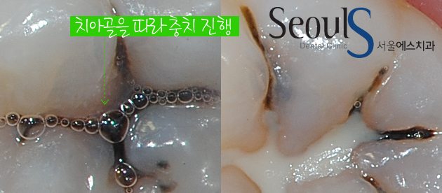 chungchi_04