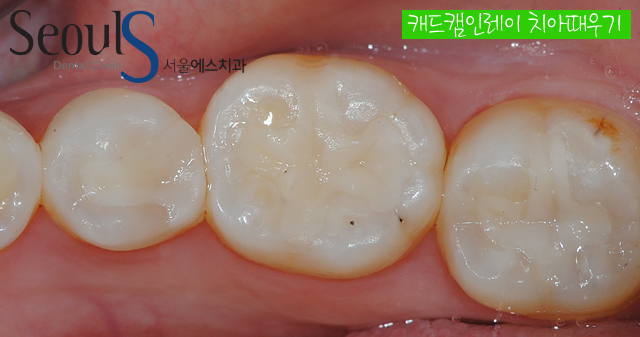 chungchi_07
