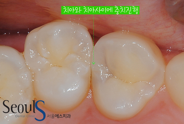 chungchi_10