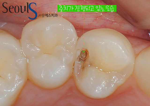 chungchi_11