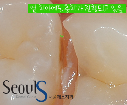 chungchi_12