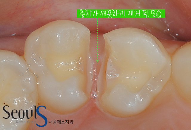 chungchi_14