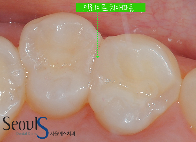 chungchi_15-1