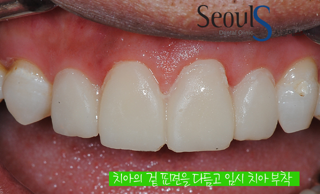lami_4