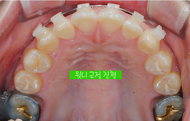 orth_process_10