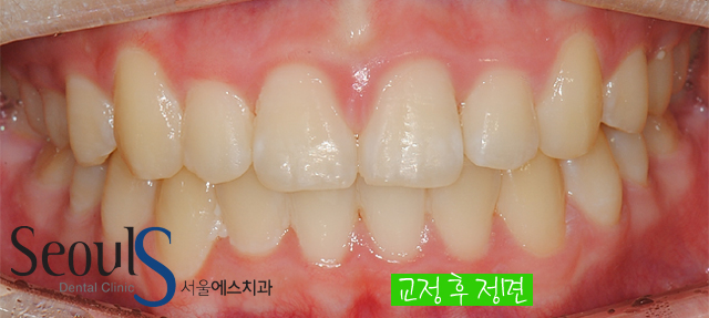 orth_process_11
