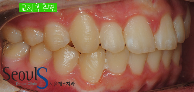 orth_process_12