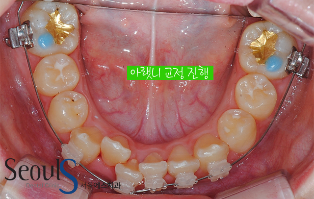 orth_process_9