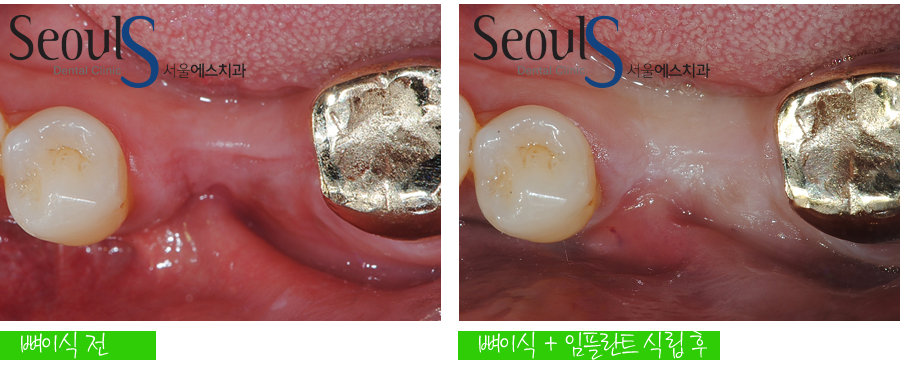 ex_imp_yeamjung (11)