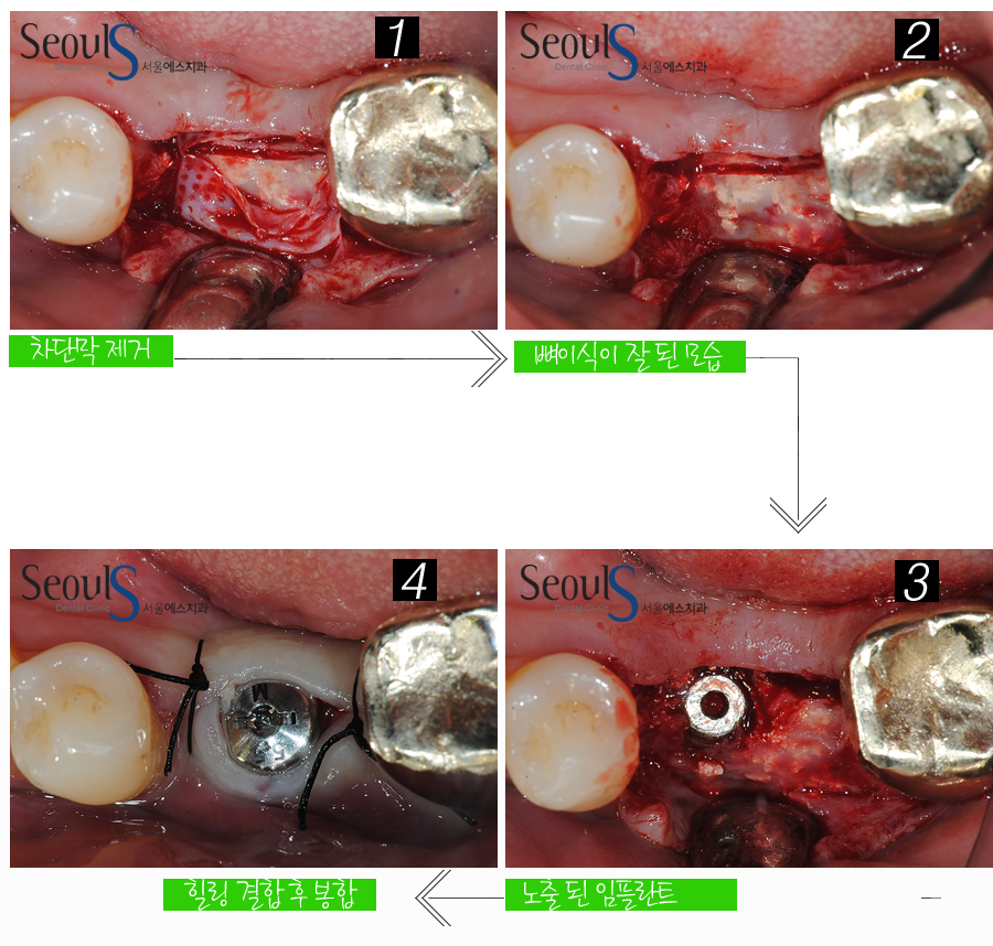 ex_imp_yeamjung (12)