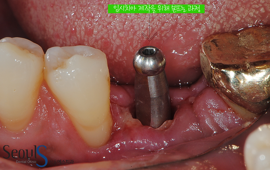 ex_imp_yeamjung (13)