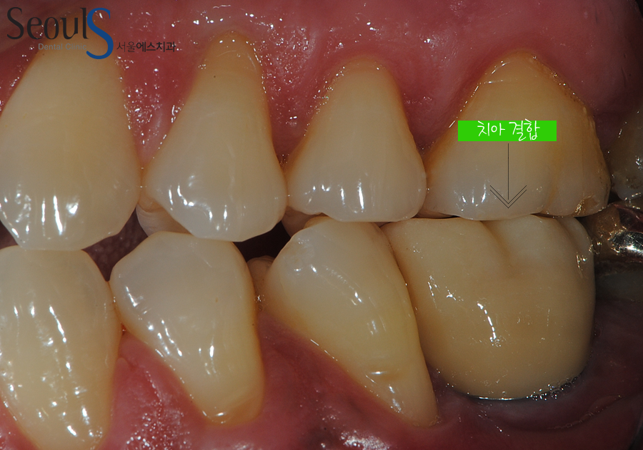 ex_imp_yeamjung (15)