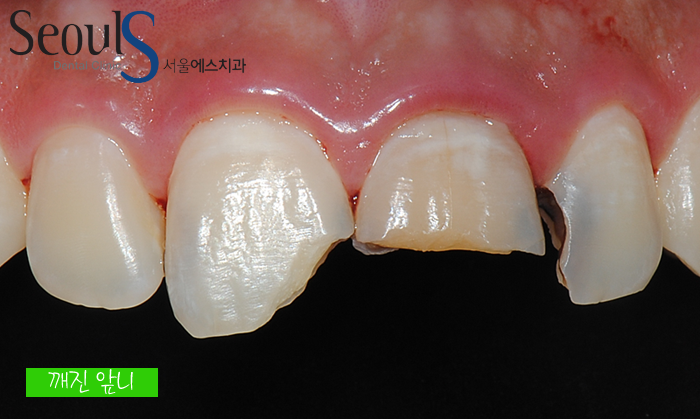 ex_simmi_kangjungho_1