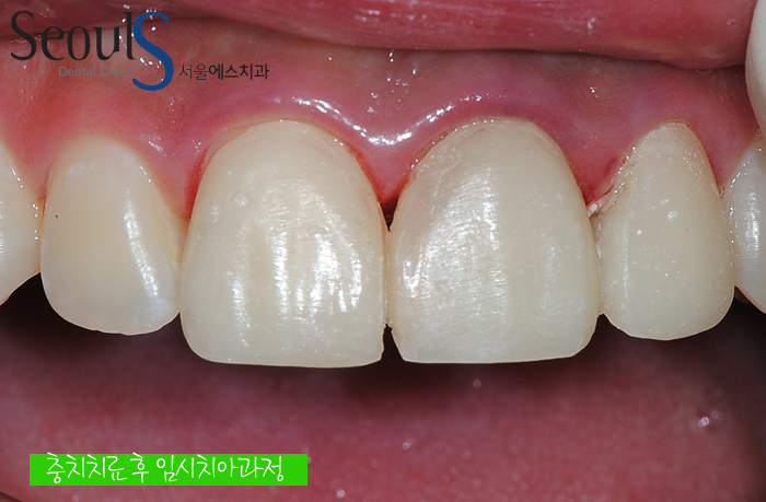 ex_simmi_kangjungho_3