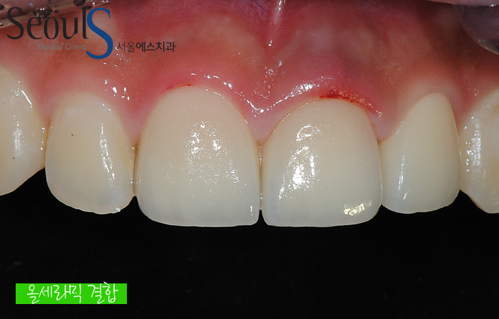 ex_simmi_kangjungho_4