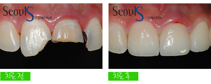 ex_simmi_kangjungho_5