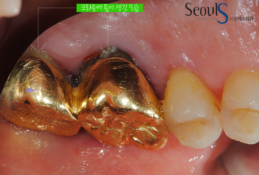 ilban20160615crown (4)
