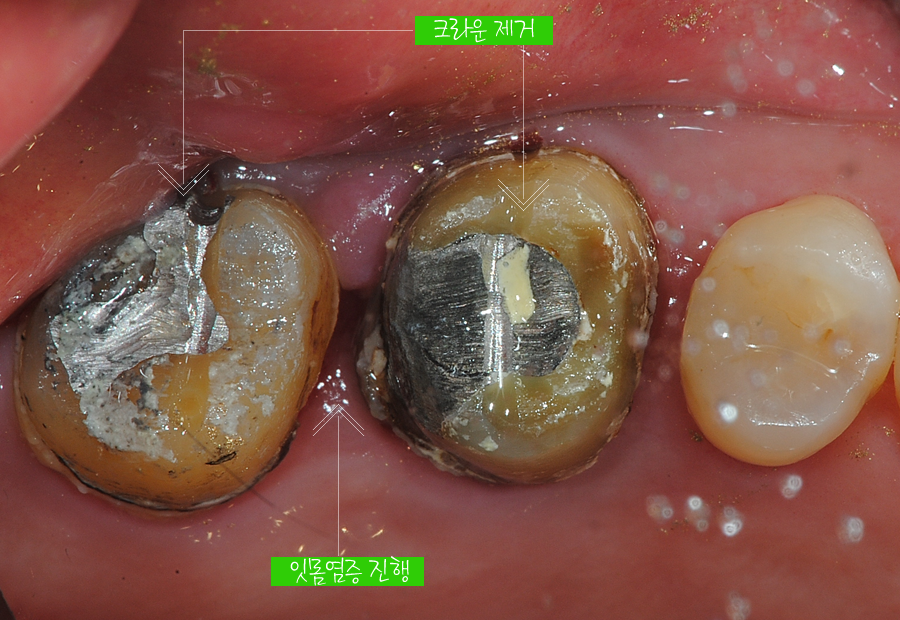 ilban20160615crown (5)