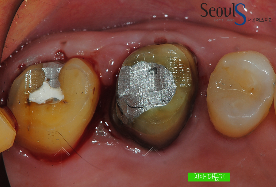 ilban20160615crown (6)