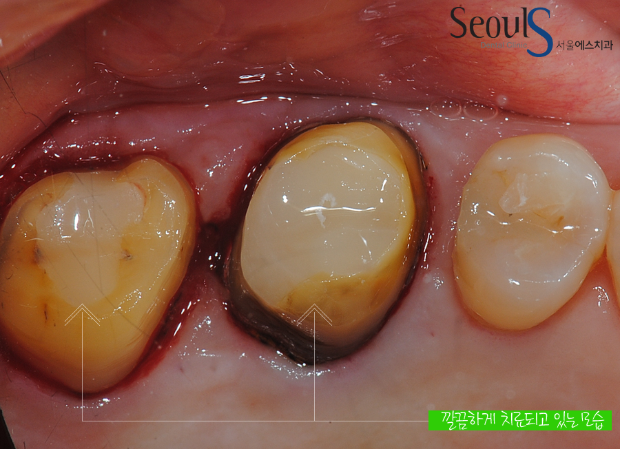 ilban20160615crown (7)
