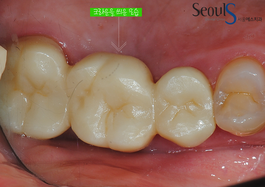 ilban20160615crown (8)