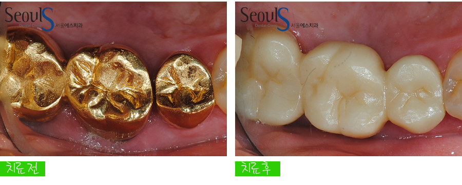 ilban20160615crown (9)