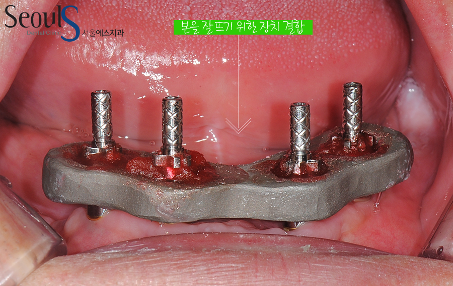 impmechiak20160614 (10)