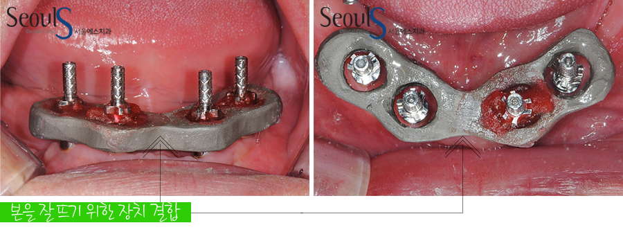 impmechiak20160614 (11)