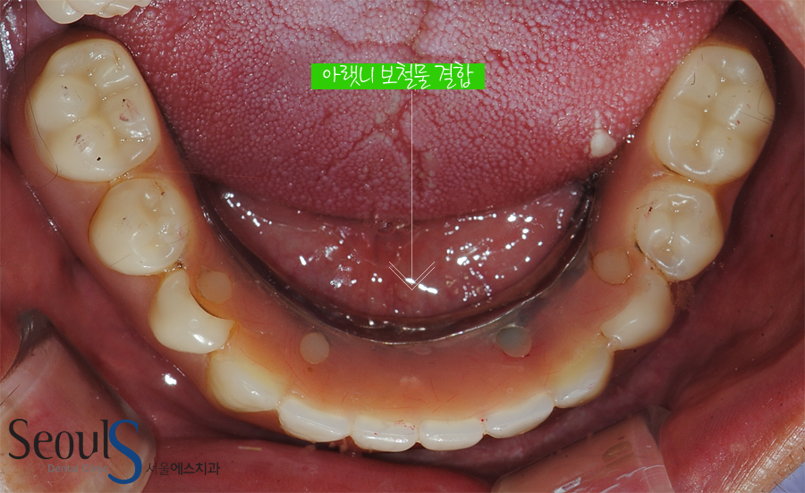 impmechiak20160614 (12)