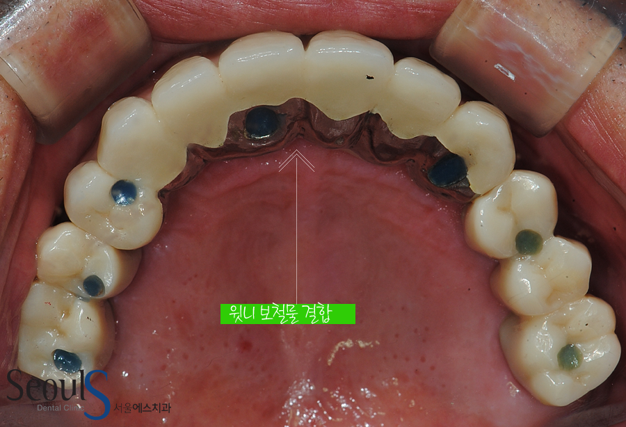 impmechiak20160614 (13)