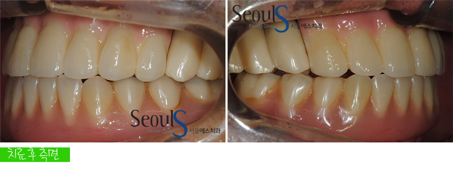 impmechiak20160614 (14)