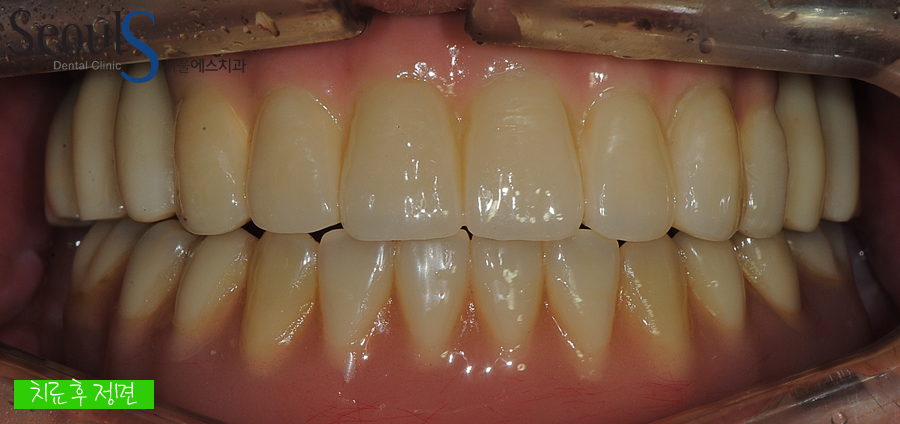 impmechiak20160614 (15)