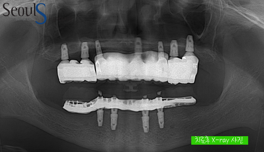 impmechiak20160614 (16)