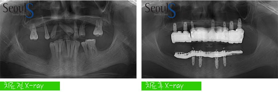 impmechiak20160614 (17)
