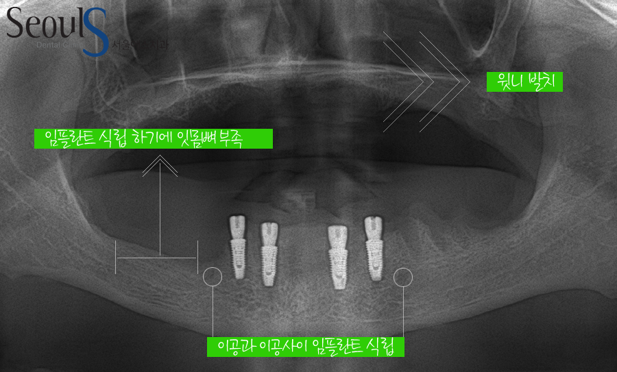 impmechiak20160614 (2)